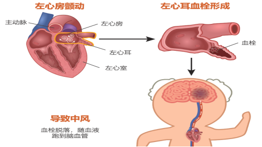 杭州英智康复医院 康复医院 康复 杭州英智康复医院 康复医院 康复